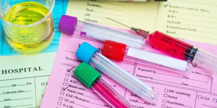 test tube labels resistant industrial